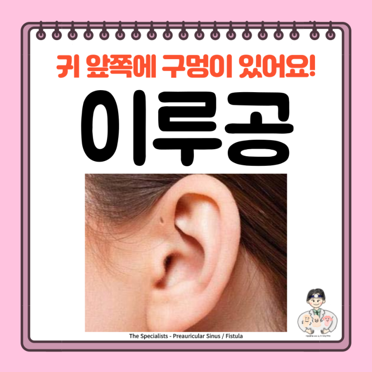  선천성 이루공, 전이개 누공, 원인 증상 염증 치료 수술