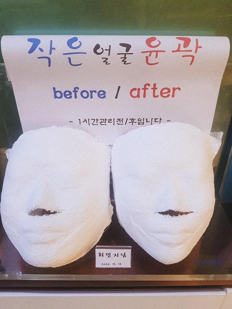  당산역피부관리 추천, 디오스킨앤바디 옆광대/얼굴 작아지는 법