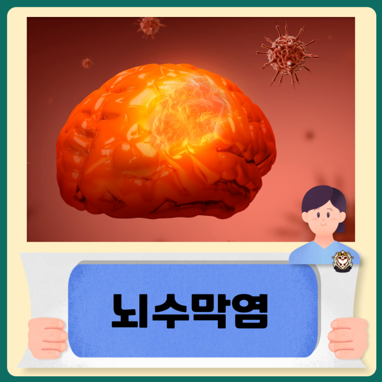  성인 뇌수막염 증상 및 치료방법