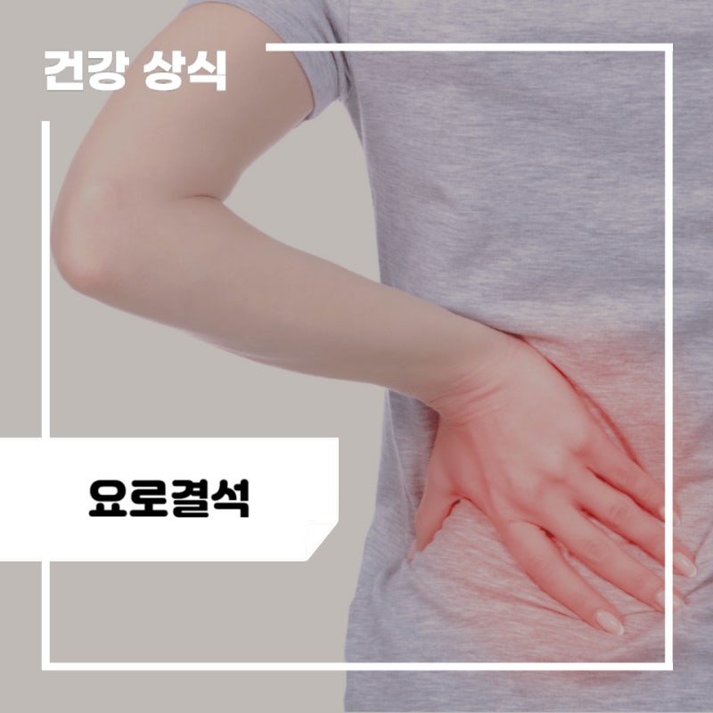 요로결석 증상 및 원인, 치료, 수술, 제거 방법, 음식 예방법, 통증 부위 : 남자, 여자(여성) : 네이버 블로그