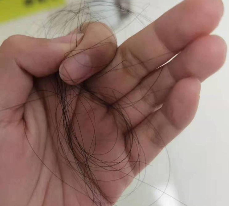  집에서 손쉽게 하는 탈모진단