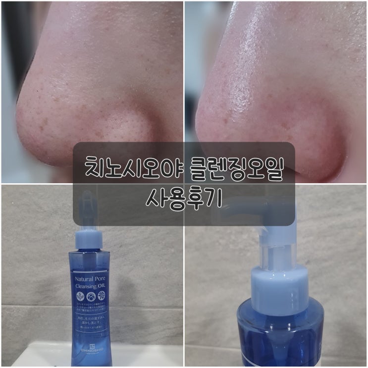 피부관리사 지망생이 선택 한 블랙헤드 클렌징 오일 "치노시오야" 사용 후기 / 1일차, 즉각 효과 나온ㄷㄷ 피부관리사 지망생이 선택 한 블랙헤드 클렌징 오일 "치노시오야" 사용 후기 / 1일차, 즉각 효과 나온ㄷㄷ