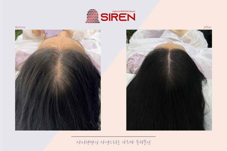  창원두피문신 자연스럽게 잘하는 곳이 있다고 하던데...