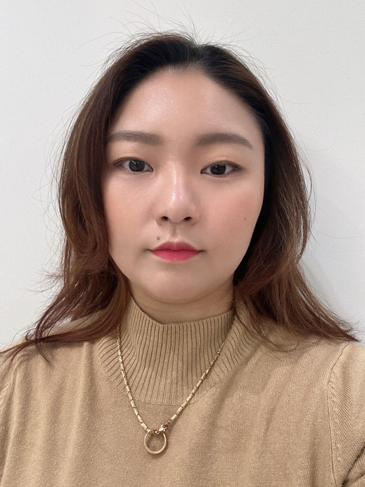 "대구반월당피부과 벨로테로 팔자주름필러 볼륨부스터 추천 후기