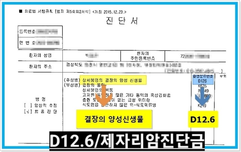 D12.6 결장의 양성신생물로 제자리암진단금 쉽게 받는 방법