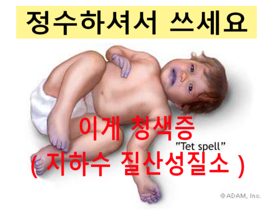  지하수 질산성질소 31 mg/L 불검출, 경남 시골읍내 논뚜렁에 임시설치
