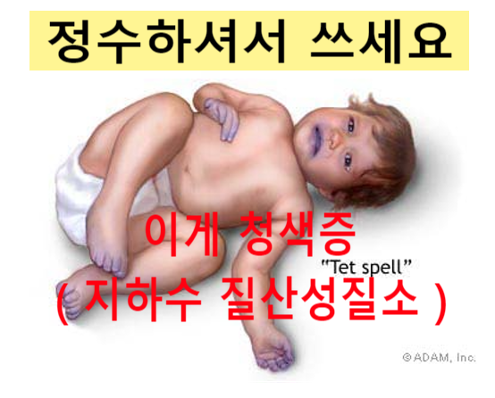 지하수 질산성질소 31 mg/L 불검출, 경남 시골읍내 논뚜렁에 임시설치