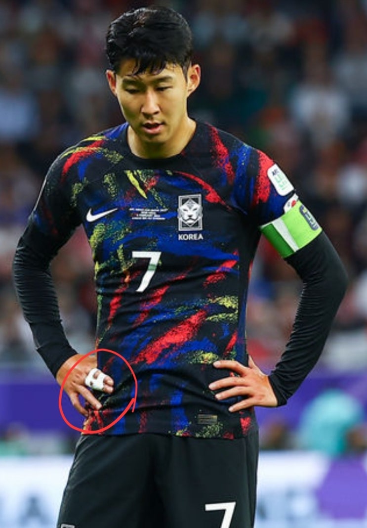 손흥민 이강인 다툼 손가락 부상 탈구 축구협회 탁구 <b>설영우</b>