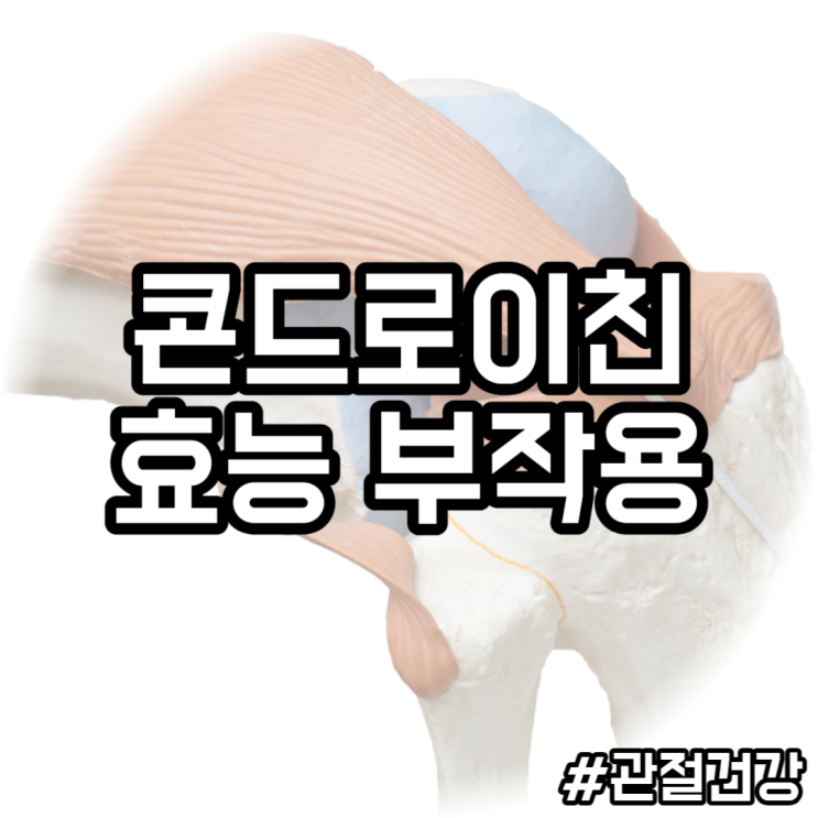  새로운 관절 건강의 지혜, 상어 연골 콘드로이친