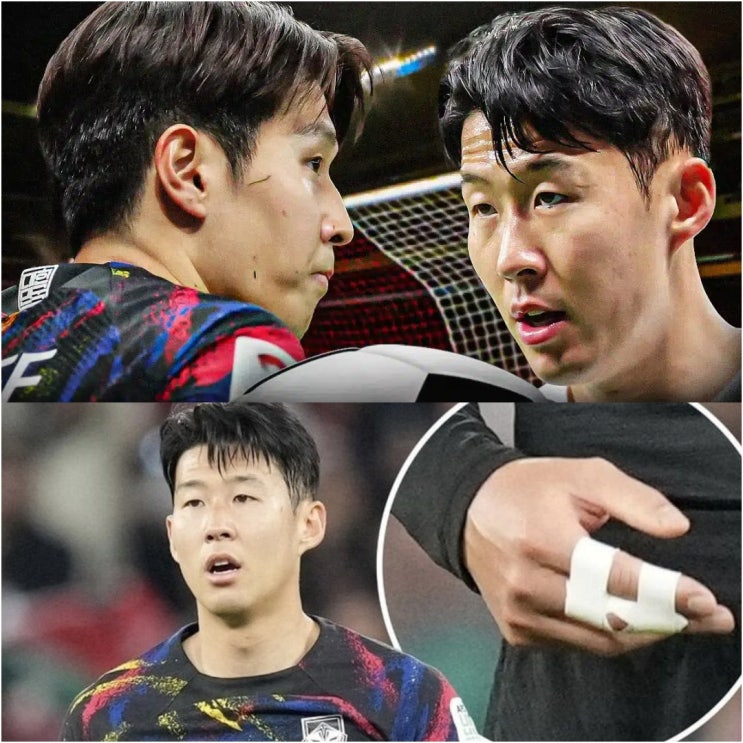 <b>손흥민</b> 이강인 탁구 몸싸움 <b>손가락</b> 탈구 부상 사건의 전말
