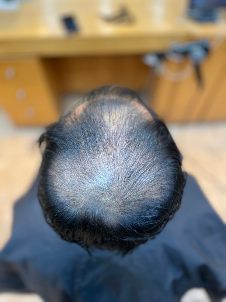  남성탈모펌 입금후 부산사상탈모전문르네시떼6층미용실/ 가야김해대저밀양화명덕천금곡백양장유덕계울산양산명지에코델타녹산물금연산전포괘법해운대동래사직광안리민락수영망미토곡범천남포초량영도감만북항