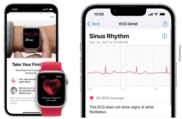 [Q&A] 건강 관리 가능한 애플워치 추천 feat. 심장 질환 관련 측정 센서