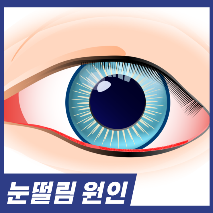 눈떨림 원인! 마그네슘 부족 외에 5가지 원인 해결방법 알고가세요.