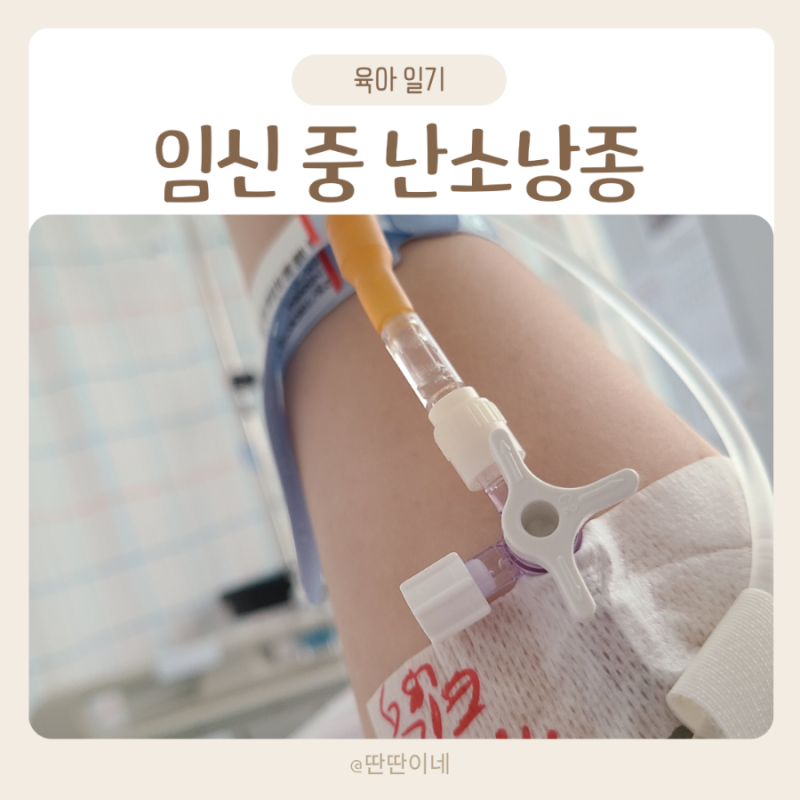 난소낭종 수술 후 재발/임신 중 난소혹 크기