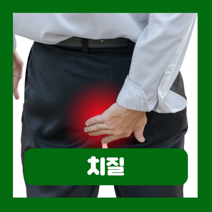  치질 종류 치루 치열 치핵 차이 초기증상 치료 좌욕 효과