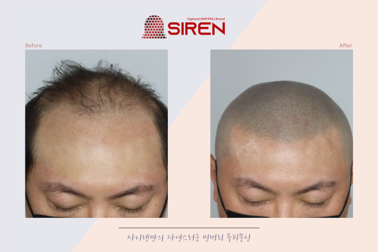  부산두피문신 가격 착하고 실력있는 곳 찾고있다면