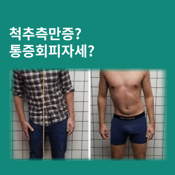 갑자기 허리가 휘어져 있다면? 이게 척추측만증일까? 갑자기 허리가 휘어져 있다면? 이게 척추측만증일까?
