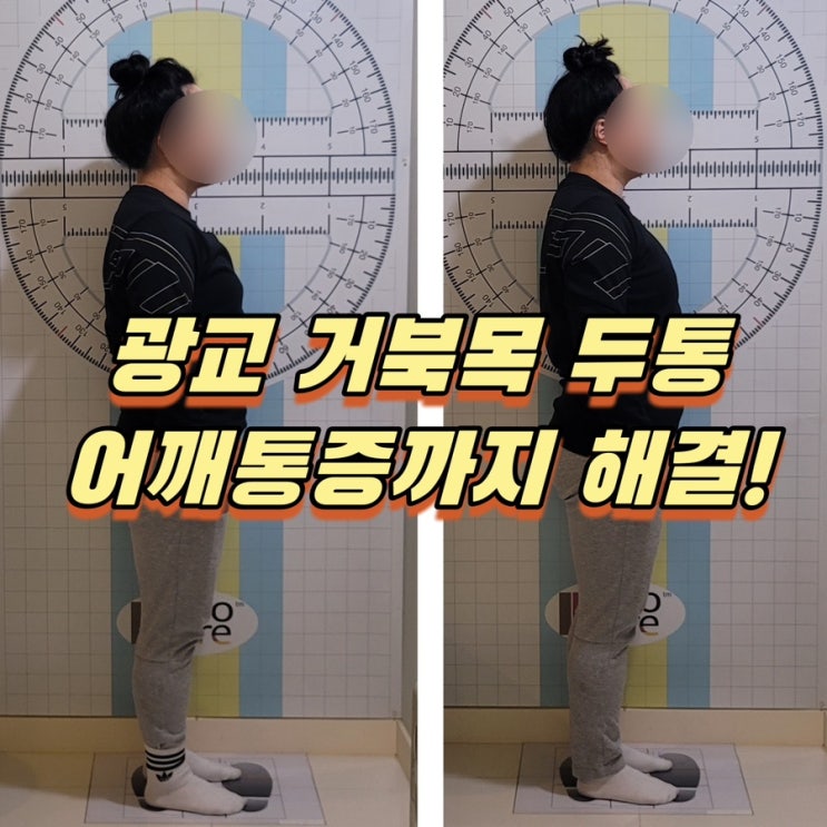  광교통증관리 두통 해결완료! 영앤밸런스테라피