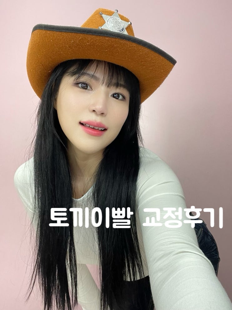  [노원치아교정] 노원치과 토끼이빨 클리피씨 부분교정 / 교정기 떼고 유지장치 시작 1탄