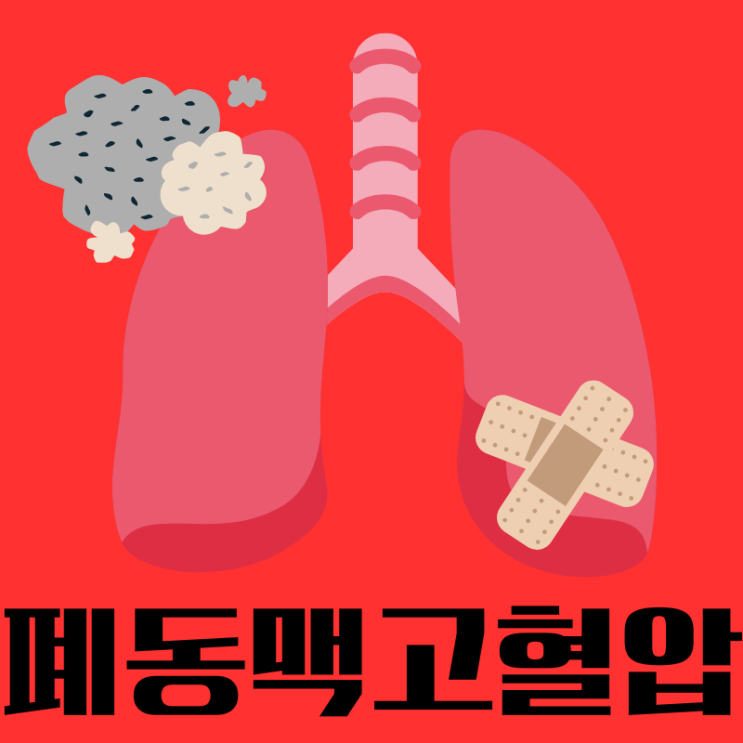  폐동맥 고혈압 진단 전조증상