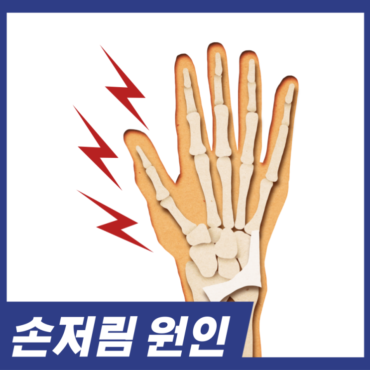  손저림 원인! 손이 저린 이유 손이 저릴때 알아보세요.