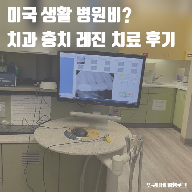  미국 생활 병원비? 치과 충치 레진 치료 보험 적용 후기