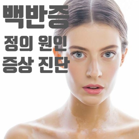  백반증(Vitiligo)이란 무엇일까요?