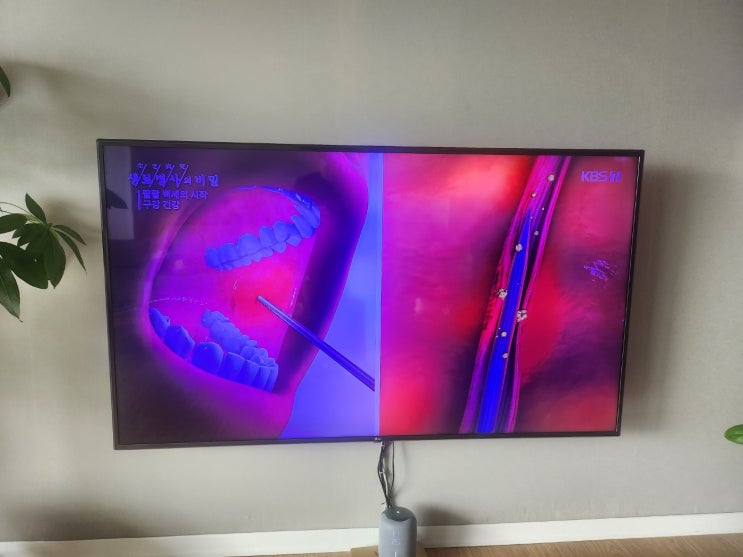  티비 백라이트 교체 lg tv 75인치 남양주 사설 출장 수리 전문