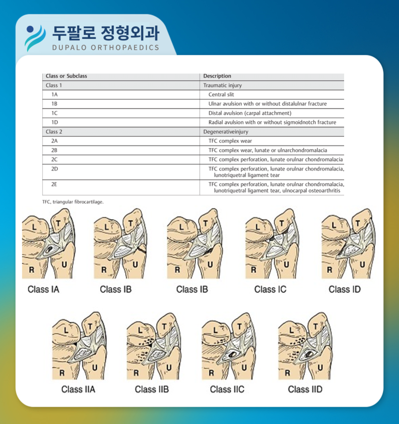 TFCC(삼각섬유연골복합체) 손상 진단부터 치료까지 : 네이버 블로그