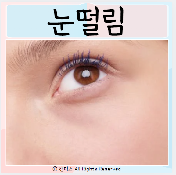  눈밑떨림 원인 한쪽눈떨림 스트레스