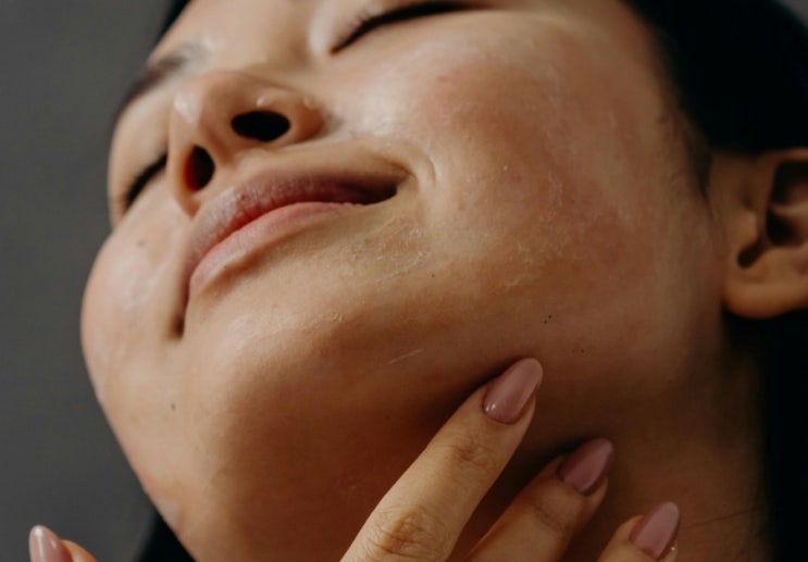  피부 화학적각질제거방법 AHA BHA 차이 PHA LHA (1)