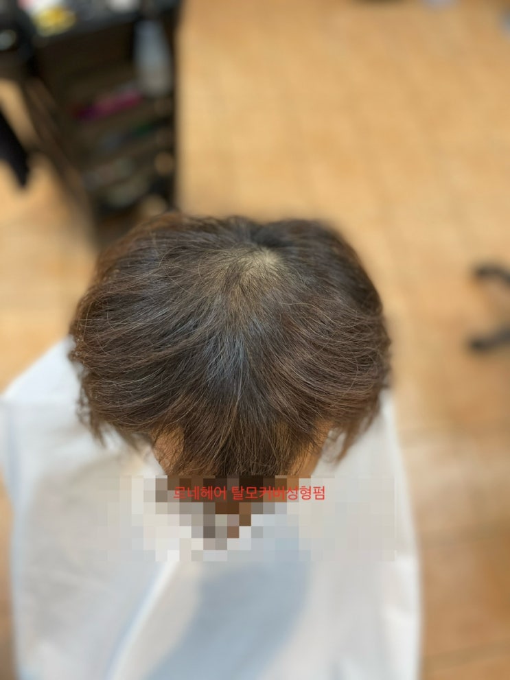  M탈모시술후 남자탈모커버펌과해독염색 부산사상르네시떼탈모전문복구케어전문미용실