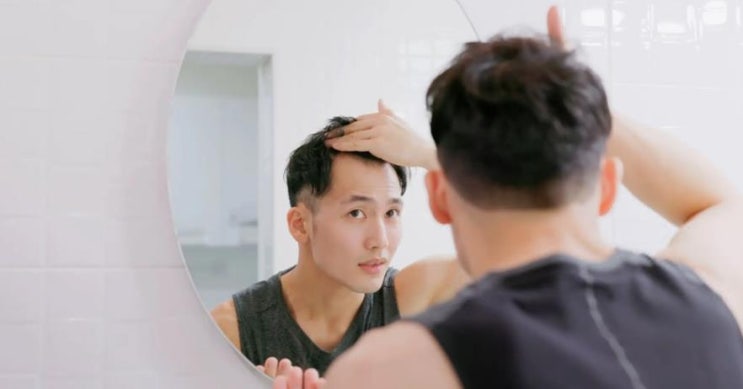  모발이식비용 보다 모발이식생착률을 먼저 생각해야 l 한올성형외과