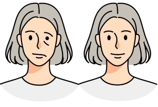 부산 동래 안면마비 한의원.. 보름 지나면 치료 어려워..?