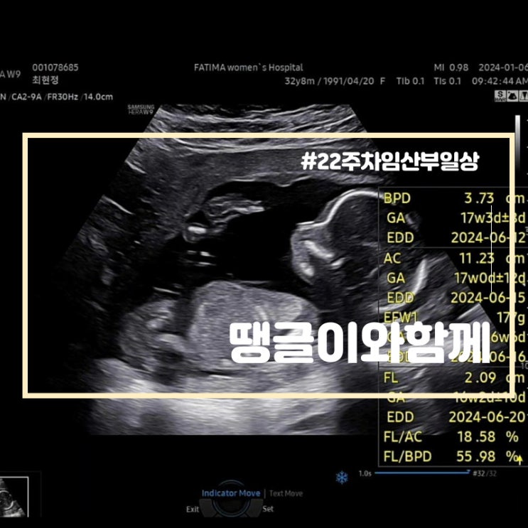  22주차 임산부 일상(ft.코노)