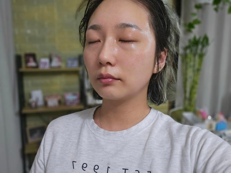  야탑역피부과 셀엑소좀 블랙라벨 솔직후기