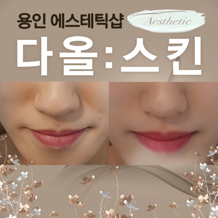  용인에스테틱 화장품처방 전문가 원장님, 다올스킨에서 윤곽관리 너무만족스러운 후기