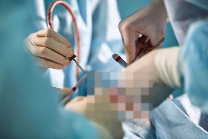 남성 성기 확대 수술중 절단 사고 의료사고 의사 2400만원 배상판결