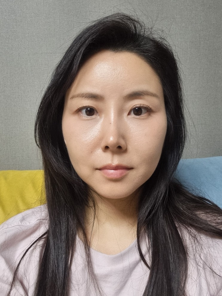 압구정 윤곽주사 / 광대축소 조각주사 찐후기 압구정 윤곽주사 / 광대축소 조각주사 찐후기