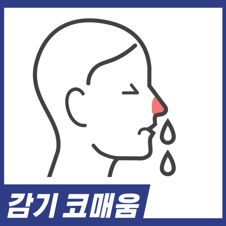  감기 코매움! 코가 매워요 코매움 원인 해결방법 알고가세요.