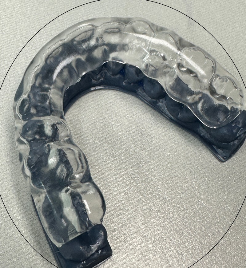 Digital Splint : 네이버 블로그