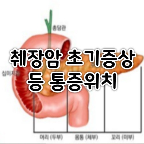 췌장암의 초기증상 10가지와 췌장암 등통증 위치 : 네이버 블로그