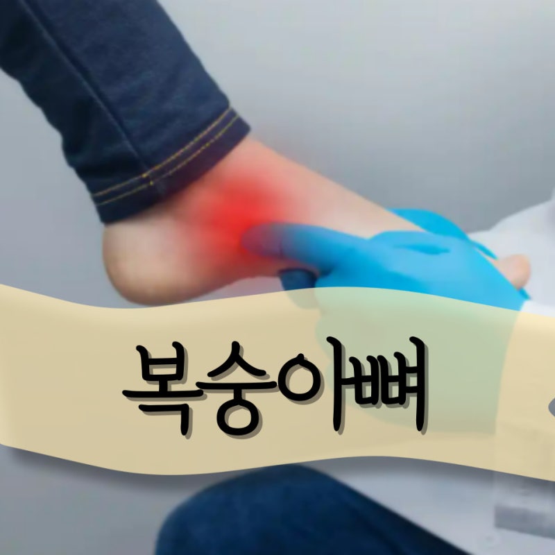 복숭아뼈 점액낭염 물혹 골절 굳은살 관리 이렇게하세요