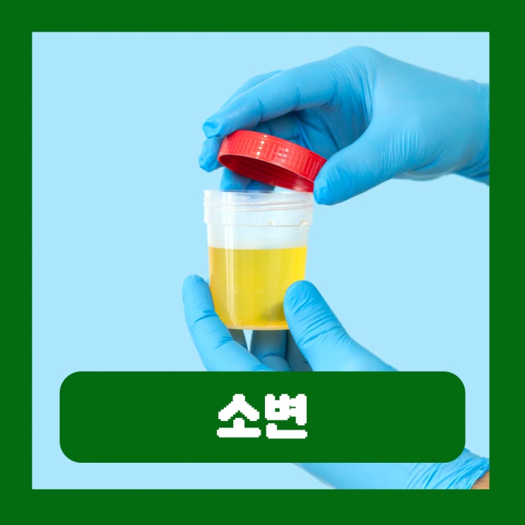  아침에 소변 거품 여자 임산부 남자 단백뇨 원인