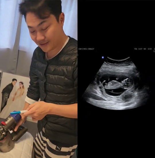 NRG <b>이성진</b> 결혼 2년만에 아빠 <b>된다</b> 이젠 6식구 태명은 뽁뽁이... 