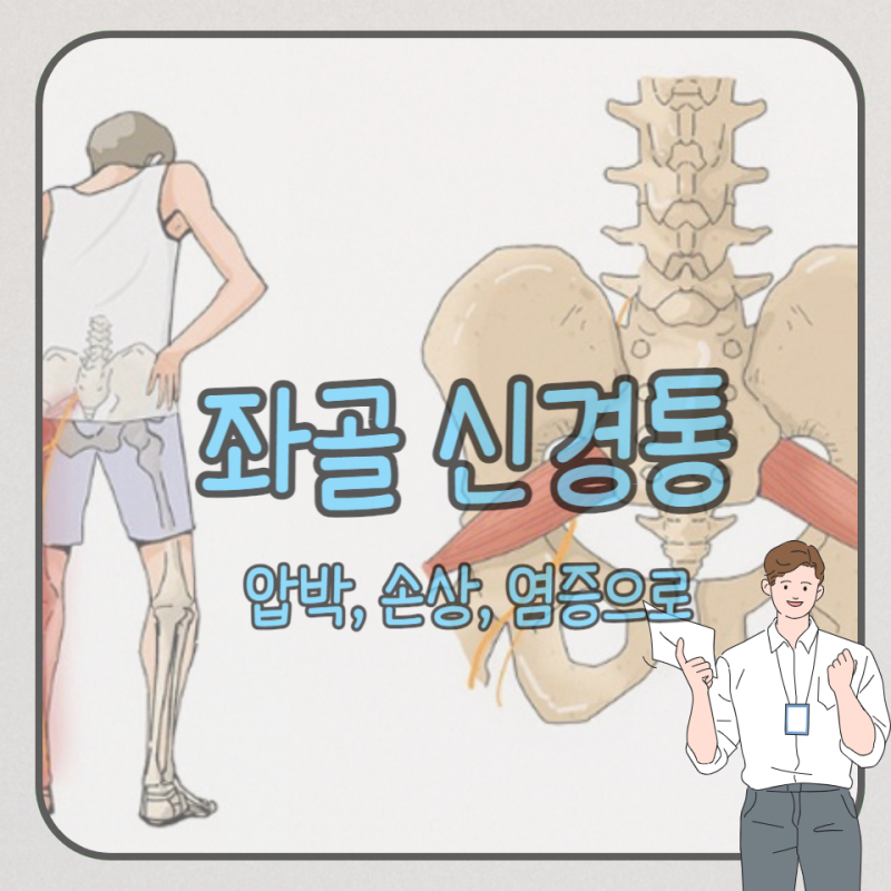 좌골신경통 원인과 검사하면 치료 가능할까?