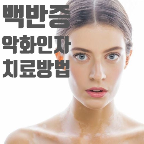  백반증(Vitiligo)의 악화인자와 치료