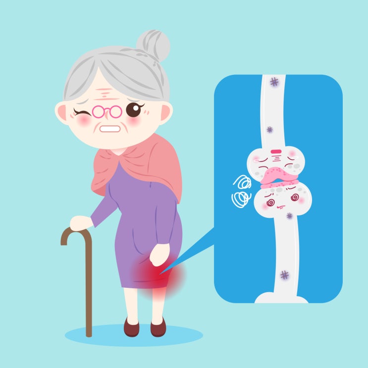  계단 내려갈 때 무릎이 시큰시큰/ 무릎 연골주사의 모든 것  (의사 작성)
