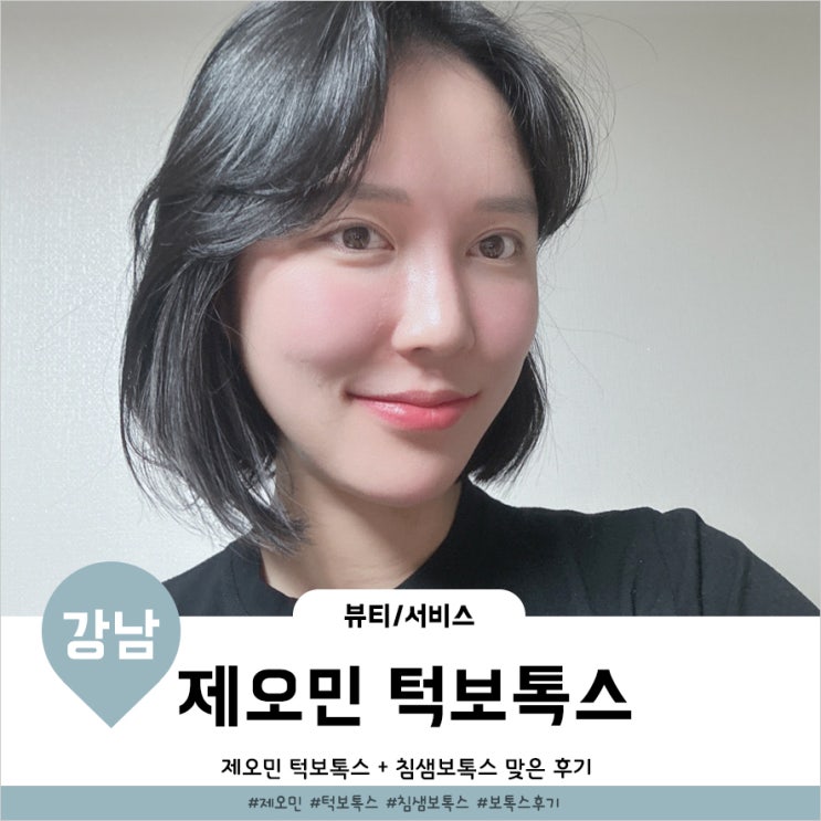  제오민 턱보톡스 효과 턱밑 침샘보톡스 6개월 주기 후기