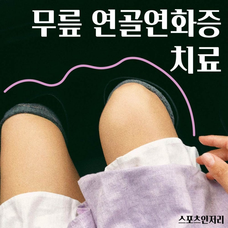 무릎 연골연화증 치료 초기에